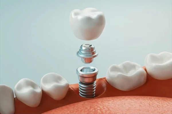 Bagga Dental